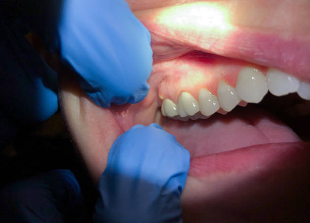 Best Walk-In Emergency Dentist in Honeygo, MD